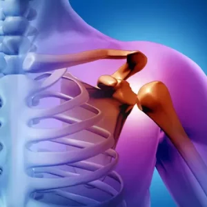 درمان و جلوگیری از آسیب های شانه