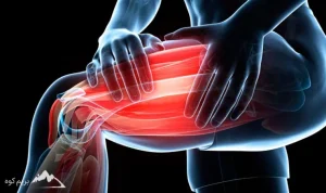 بدن درد بعد از کوهنوردی؛رفع گرفتگی عضلات بعد از کوهنوردی