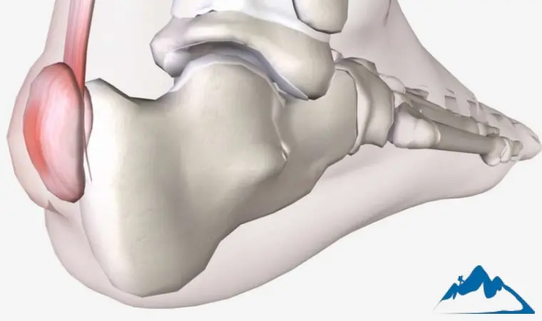 هاگلند در کوهنوردی